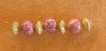 Iridescent Rose Marbled Bead Set 7